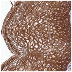LHFPL4, Rabbit, Polyclonal Antibody, Abnova 100 &mu;L | Buy Online | Abnova Corporation | Fisher Scientific
