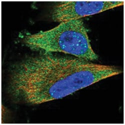 TELO2 Rabbit anti-Human, Polyclonal Antibody, Abnova 100 &mu;L | Buy Online | Abnova Corporation | Fisher Scientific