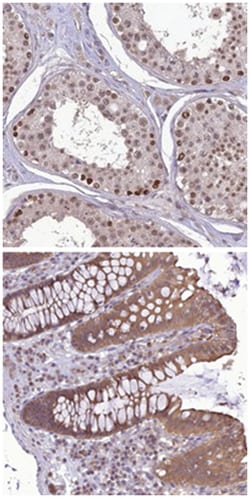 TIGD7 Rabbit anti-Human, Polyclonal Antibody, Abnova 100 &mu;L | Buy Online | Abnova Corporation | Fisher Scientific