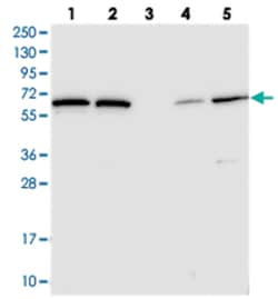 POLR3E, Rabbit, Polyclonal Antibody, Abnova 100 &mu;L | Buy Online | Abnova Corporation | Fisher Scientific
