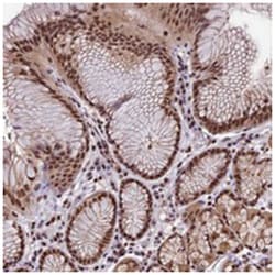 POLR3E, Rabbit, Polyclonal Antibody, Abnova 100 &mu;L | Buy Online | Abnova Corporation | Fisher Scientific
