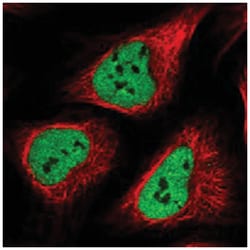 POLR3E, Rabbit, Polyclonal Antibody, Abnova 100 &mu;L | Buy Online | Abnova Corporation | Fisher Scientific