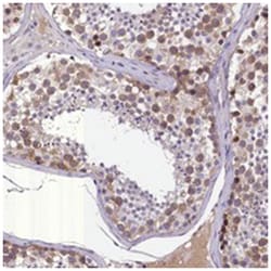 C16orf48 Rabbit anti-Human, Polyclonal Antibody, Abnova 100 &mu;L | Buy Online | Abnova Corporation | Fisher Scientific