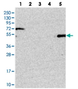 SETD6, Rabbit, Polyclonal Antibody, Abnova 100 &mu;L | Buy Online | Abnova Corporation | Fisher Scientific