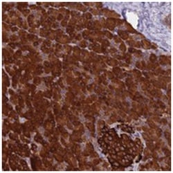 SETD6, Rabbit, Polyclonal Antibody, Abnova 100 &mu;L | Buy Online | Abnova Corporation | Fisher Scientific