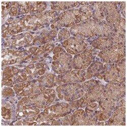CCDC153, Rabbit, Polyclonal Antibody, Abnova 100&mu;L; Unlabeled:Antibodies,