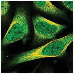 FAM96B Rabbit anti-Human, Polyclonal Antibody, Abnova 100&mu;L; Unlabeled:Antibodies,