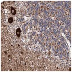 DEXI, Rabbit, Polyclonal Antibody, Abnova 100&mu;L; Unlabeled:Antibodies,