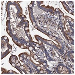 CCDC135, Rabbit, Polyclonal Antibody, Abnova 100 &mu;L | Buy Online | Abnova Corporation | Fisher Scientific