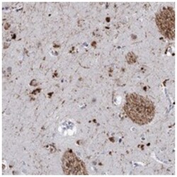 C16orf72, Rabbit, Polyclonal Antibody, Abnova 100&mu;L; Unlabeled:Antibodies,