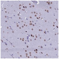 FAM169A, Rabbit, Polyclonal Antibody, Abnova 100 &mu;L | Buy Online | Abnova Corporation | Fisher Scientific