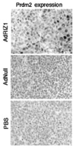 PRDM2, Rabbit, Polyclonal Antibody, Abnova 400 &mu;L | Buy Online | Abnova Corporation | Fisher Scientific