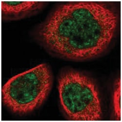 EVX2, Rabbit, Polyclonal Antibody, Abnova 100 &mu;L | Buy Online | Abnova Corporation | Fisher Scientific