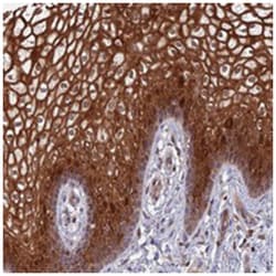 TSPAN16, Rabbit, Polyclonal Antibody, Abnova 100&mu;L; Unlabeled:Antibodies,