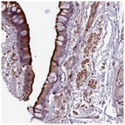 ANO3, Rabbit, Polyclonal Antibody, Abnova 100&mu;L; Unlabeled:Anticuerpos