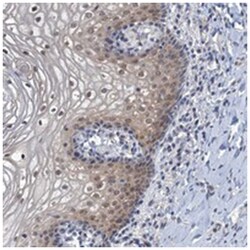 POU1F1, Rabbit, Polyclonal Antibody, Abnova 100 &mu;L | Buy Online | Abnova Corporation | Fisher Scientific