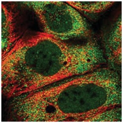 POU1F1, Rabbit, Polyclonal Antibody, Abnova 100 &mu;L | Buy Online | Abnova Corporation | Fisher Scientific
