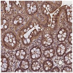 FCHO1, Rabbit, Polyclonal Antibody, Abnova 100 &mu;L | Buy Online | Abnova Corporation | Fisher Scientific