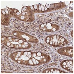 C19orf44, Rabbit, Polyclonal Antibody, Abnova 100&mu;L; Unlabeled:Antibodies,