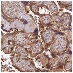 ARHGAP17, Rabbit, Polyclonal Antibody, Abnova 100 &mu;L | Buy Online | Abnova Corporation | Fisher Scientific