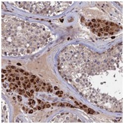 TRAPPC2L, Rabbit, Polyclonal Antibody, Abnova 100 &mu;L | Buy Online | Abnova Corporation | Fisher Scientific