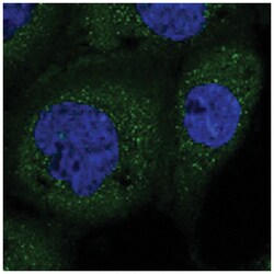 TRAPPC2L, Rabbit, Polyclonal Antibody, Abnova 100 &mu;L | Buy Online | Abnova Corporation | Fisher Scientific