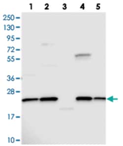 NPVF, Rabbit, Polyclonal Antibody, Abnova 100 &mu;L | Buy Online | Abnova Corporation | Fisher Scientific