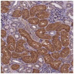 NPVF, Rabbit, Polyclonal Antibody, Abnova 100 &mu;L | Buy Online | Abnova Corporation | Fisher Scientific