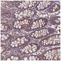 C6orf70, Rabbit, Polyclonal Antibody, Abnova 100 &mu;L | Buy Online | Abnova Corporation | Fisher Scientific