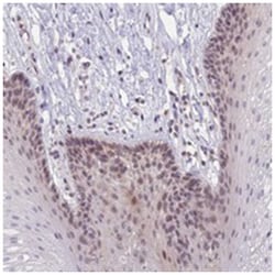 CRAMP1L, Rabbit, Polyclonal Antibody, Abnova 100 &mu;L | Buy Online | Abnova Corporation | Fisher Scientific