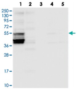 SLC38A7, Rabbit, Polyclonal Antibody, Abnova 100&mu;L; Unlabeled:Antibodies,