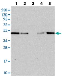 IST1, Rabbit, Polyclonal Antibody, Abnova 100&mu;L; Unlabeled:Antibodies,