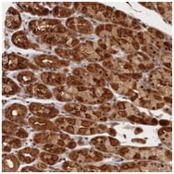 CEP44 Rabbit anti-Human, Polyclonal Antibody, Abnova 100 &mu;L | Buy Online | Abnova Corporation | Fisher Scientific