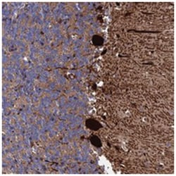 EXOSC9, Rabbit, Polyclonal Antibody, Abnova 100 &mu;L | Buy Online | Abnova Corporation | Fisher Scientific