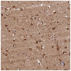 KATNB1 Rabbit anti-Human, Polyclonal Antibody, Abnova 100 &mu;L | Buy Online | Abnova Corporation | Fisher Scientific