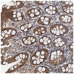 PPP1R14D, Rabbit, Polyclonal Antibody, Abnova 100&mu;L; Unlabeled:Antibodies,