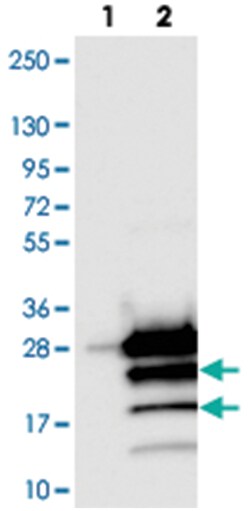 PPP1R14D, Rabbit, Polyclonal Antibody, Abnova 100&mu;L; Unlabeled:Antibodies,