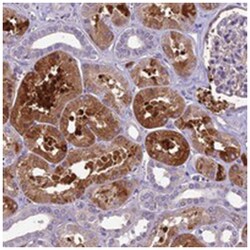 CILP2, Rabbit, Polyclonal Antibody, Abnova 100 &mu;L | Buy Online | Abnova | Fisher Scientific