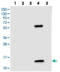 PPP4R4, Rabbit, Polyclonal Antibody, Abnova 100 &mu;L | Buy Online | Abnova Corporation | Fisher Scientific
