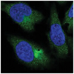 PPP4R4, Rabbit, Polyclonal Antibody, Abnova 100 &mu;L | Buy Online | Abnova Corporation | Fisher Scientific