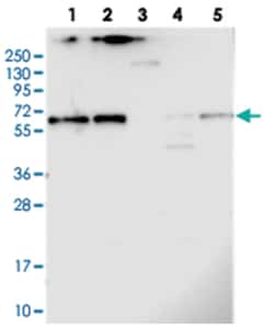 CCDC125, Rabbit, Polyclonal Antibody, Abnova 100 &mu;L | Buy Online | Abnova Corporation | Fisher Scientific