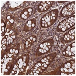 CCDC125, Rabbit, Polyclonal Antibody, Abnova 100 &mu;L | Buy Online | Abnova Corporation | Fisher Scientific