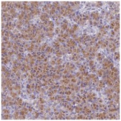 FAM212A, Rabbit, Polyclonal Antibody, Abnova 100 &mu;L | Buy Online | Abnova Corporation | Fisher Scientific
