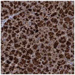 WDR88, Rabbit, Polyclonal Antibody, Abnova 100 &mu;L | Buy Online | Abnova Corporation | Fisher Scientific