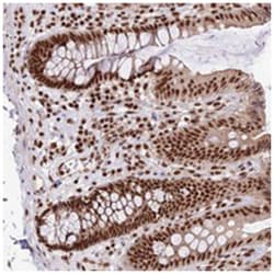 FAM103A1 Rabbit anti-Human, Polyclonal Antibody, Abnova 100 &mu;L | Buy Online | Abnova Corporation | Fisher Scientific
