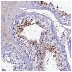 SPACA4, Rabbit, Polyclonal Antibody, Abnova 100&mu;L; Unlabeled:Antibodies,