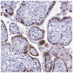 KCTD21, Rabbit, Polyclonal Antibody, Abnova 100 &mu;L | Buy Online | Abnova Corporation | Fisher Scientific