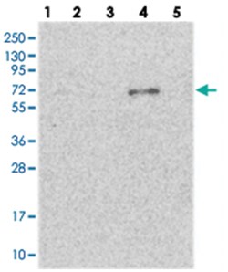 ETFDH, Rabbit, Polyclonal Antibody, Abnova 100&mu;L; Unlabeled:Antibodies,