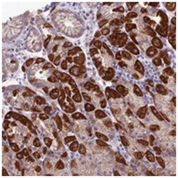 ETFDH, Rabbit, Polyclonal Antibody, Abnova 100&mu;L; Unlabeled:Antibodies,