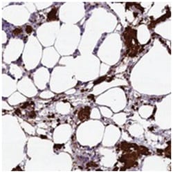 HEATR3, Rabbit, Polyclonal Antibody, Abnova 100 &mu;L | Buy Online | Abnova Corporation | Fisher Scientific